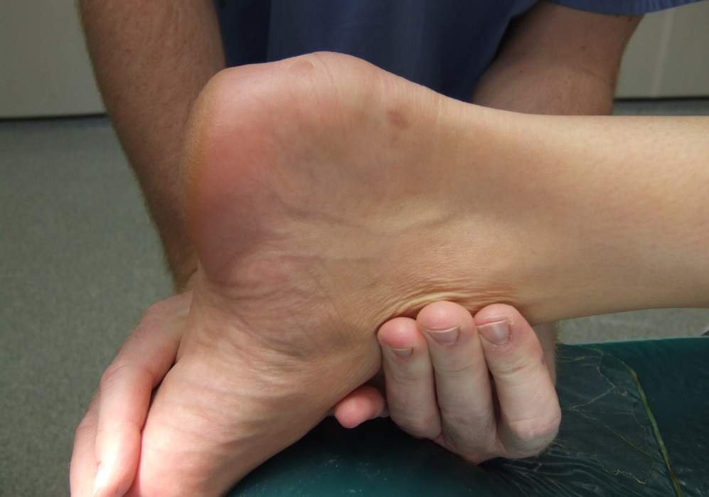 pięta haglunda leczenie